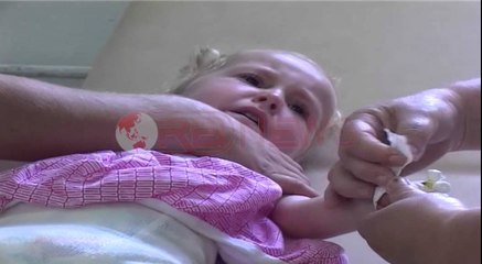 Stina e virozave, Dyndje fëmijësh në pediatrinë e Elbasanit dhe Lushnjes- Ora News