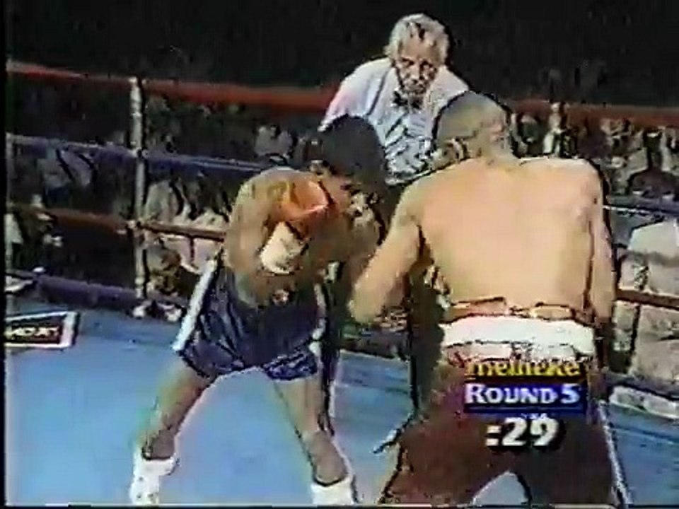 Pedro Feliciano vs Louis Curtis (Worst Boxing Hematoma ever?)