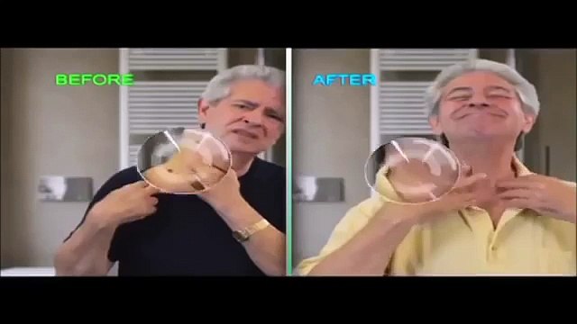 remove skin tags at home skin tag remover bio clear skin tag remover oil v2