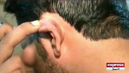 Karachi Police Poor performance