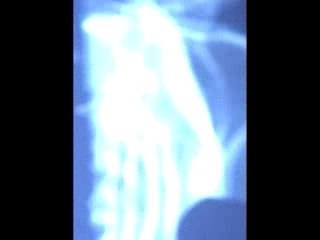 Synapses aquatiques
