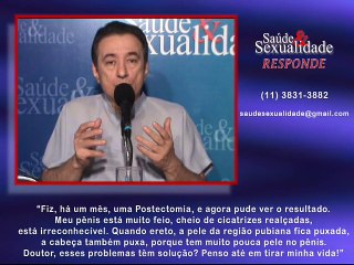 Saúde e Sexualidade Responde 74 – Postectomia, pênis com cicatrizes e pensa em tirar sua vida