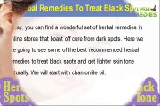 Herbal Remedies To Treat Black Spots And Get Lighter Skin Tone