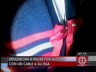Los Olivos: Denuncian a mujer que azotó con un cable a su hija