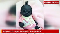 Dünyanın En Siyah Bebeğinin Sırrı Çözüldü