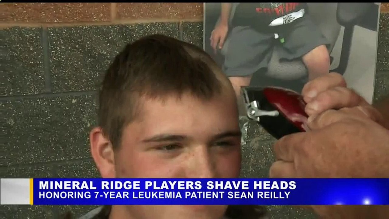 baseball shaved head for good cause