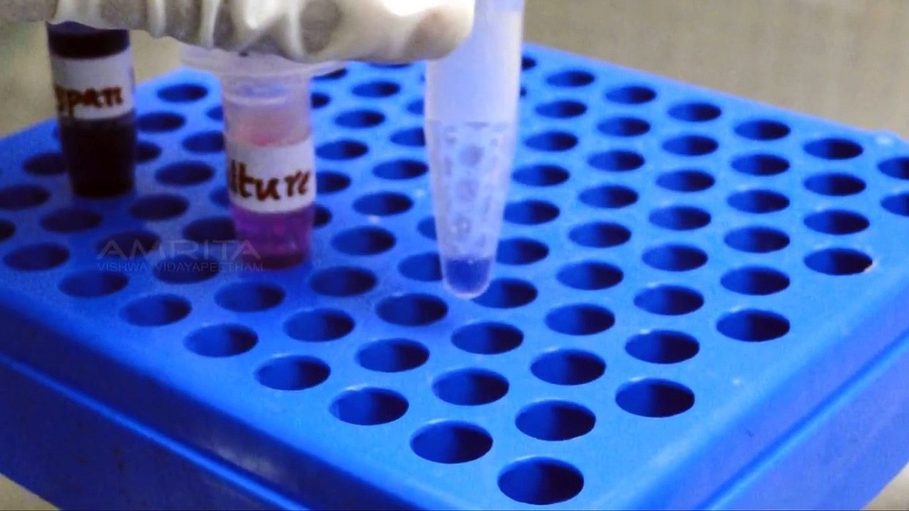 Hemocytometer - Counting of cells - Amrita University