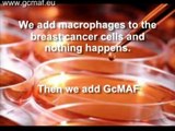 Watch as amazing GcMAF treatment kills cancer cells in real time