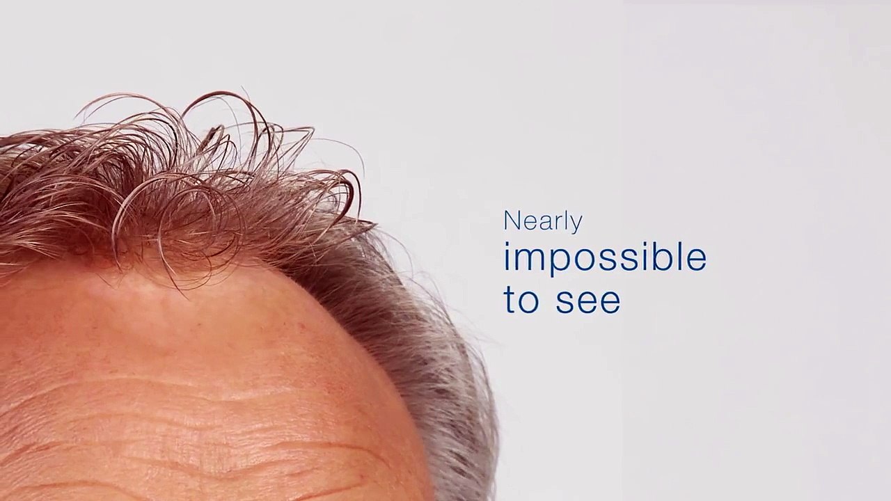 Introducing HD Skin: Revolutionizing Thin Skin Hair Systems for Men | Hair Direct