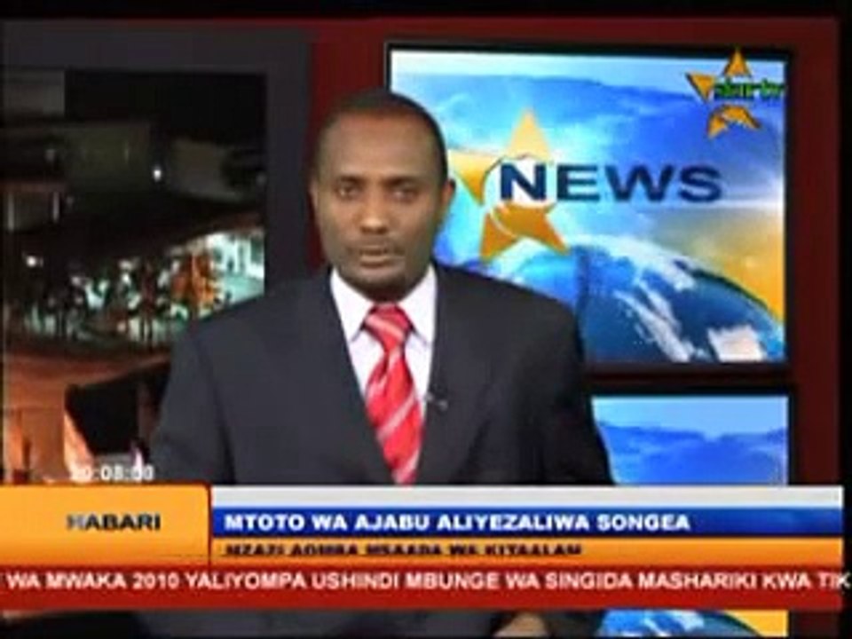 Mtoto mwenye viungo vya ajabu azaliwa Tanzania