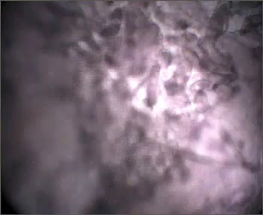 gyrodactilus