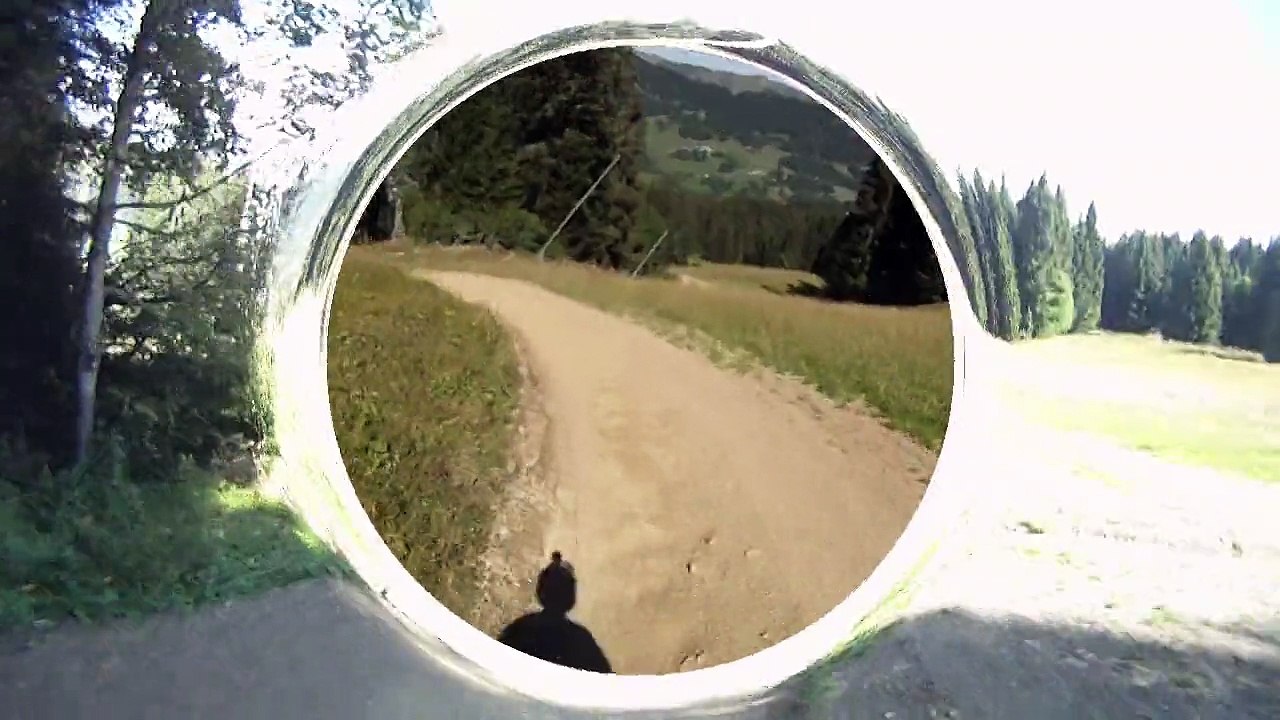 34 ans et toutes mes dents