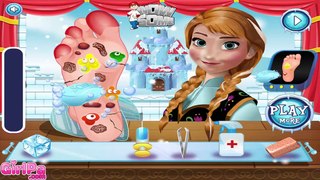 Disney Frozen Games - Anna Foot Doctor - Disney Princess Games for Girls