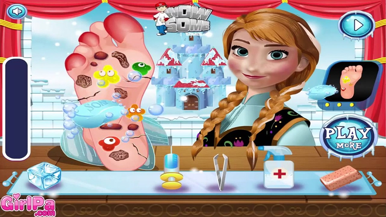 Disney Frozen Games - Anna Foot Doctor - Disney Princess Games for Girls