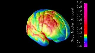 Brain maturation in teens