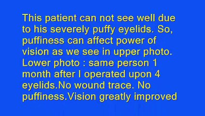 Dr Hayam Adel Consultant of plastic eyelid surgery and tattooing of scarred white cornea