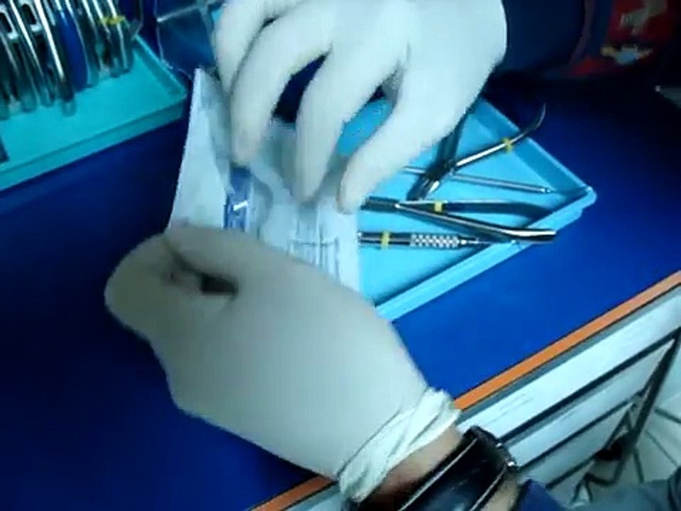 Video changing arch with Innovation C braces