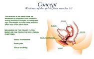 How To Rehabilitate Pelvic Floor Muscles Using FemiScan