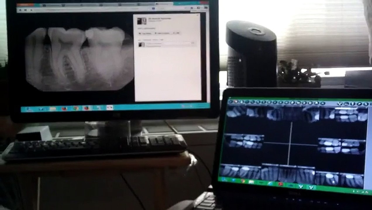 Dental X-Ray Machine