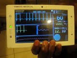 ThisisCardiopad_Video 5: The Scope on Pad,ECG monitoring