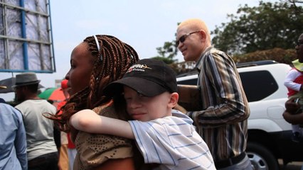 RDC: les albinos en quête de reconnaissance