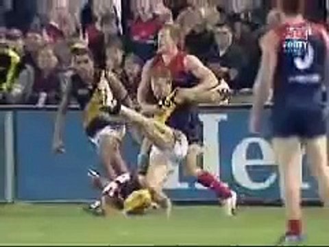 AFL Player Nathan Brown Breaks Leg