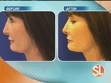 Get the face, body you deserve without surgery at EnteBella