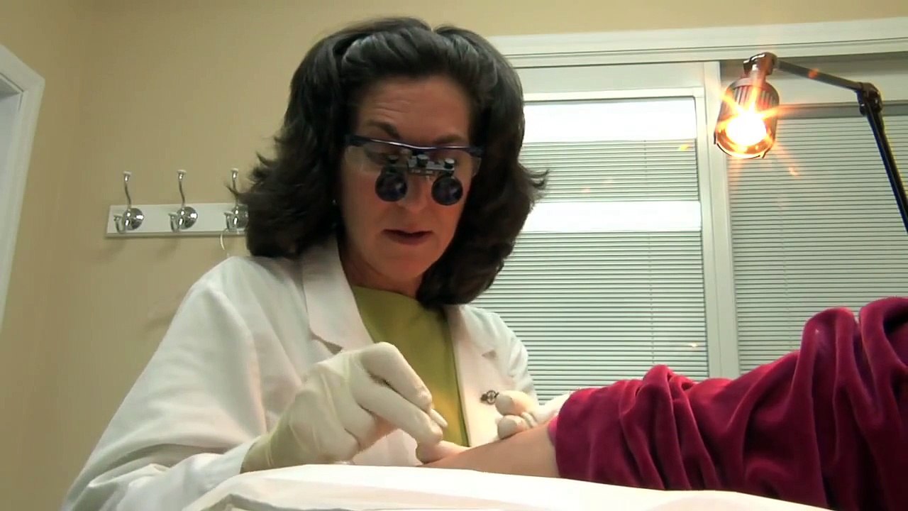 Meet The Experts- Electrolysis Vs. Laser Hair Removal For Men & Women