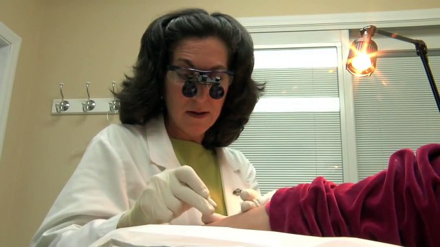 Meet The Experts- Electrolysis Vs. Laser Hair Removal For Men & Women