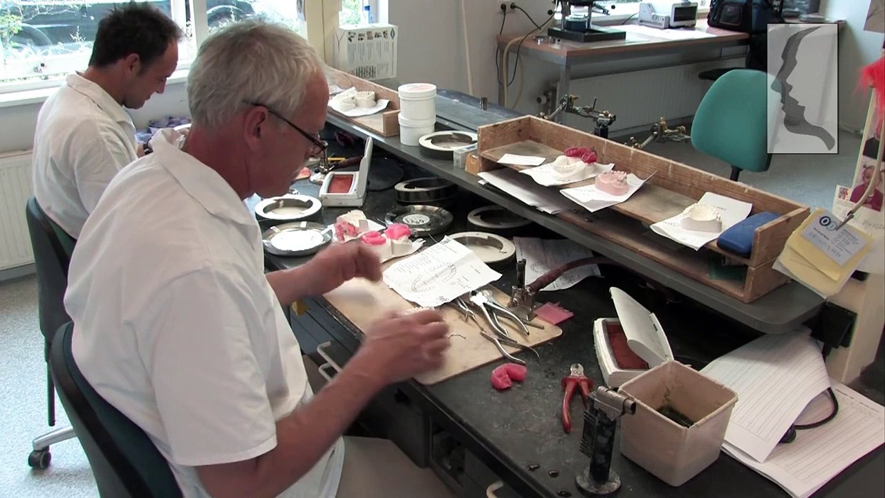 Orthodontiepraktijk Leeuwarden: De verschillende soorten beugels