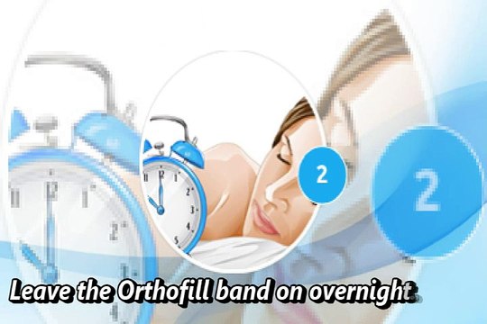 Orthofill Fix Teeth Gap Bands in Mesa