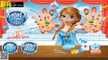 Disney Frozen Game - Frozen Anna Hand Doctor Baby Videos Games For Kids