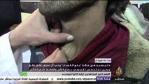 ساعة صباح - أسبابه وطرق علاجه