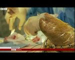 Quest to grow human organs inside pigs in Japan
