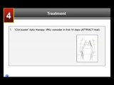 Part 4: Treatment - DVT and PE: What Patients Need to Know