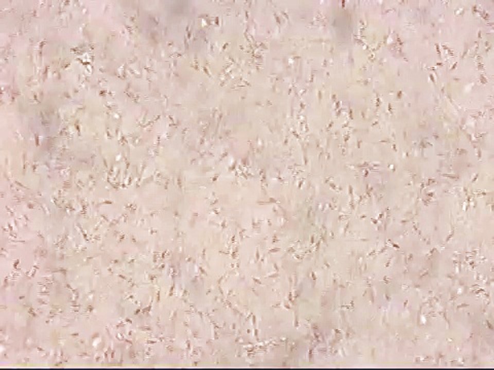Sperme, au microscope, de mon colley