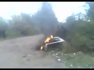 Artistlik Yapayım Derken Götü Yakmak   Video