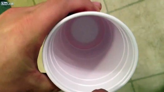 Pissing a kidney stone in to cup. - Dailymotion Video