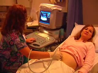 New Ultrasound at Riverside Methodist to Check for Downs Syndrome & other chromosome diseases
