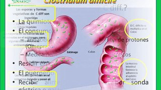 Infección por Clostridium Difficile