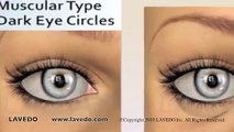 Dark Eye Circles causes and treatments