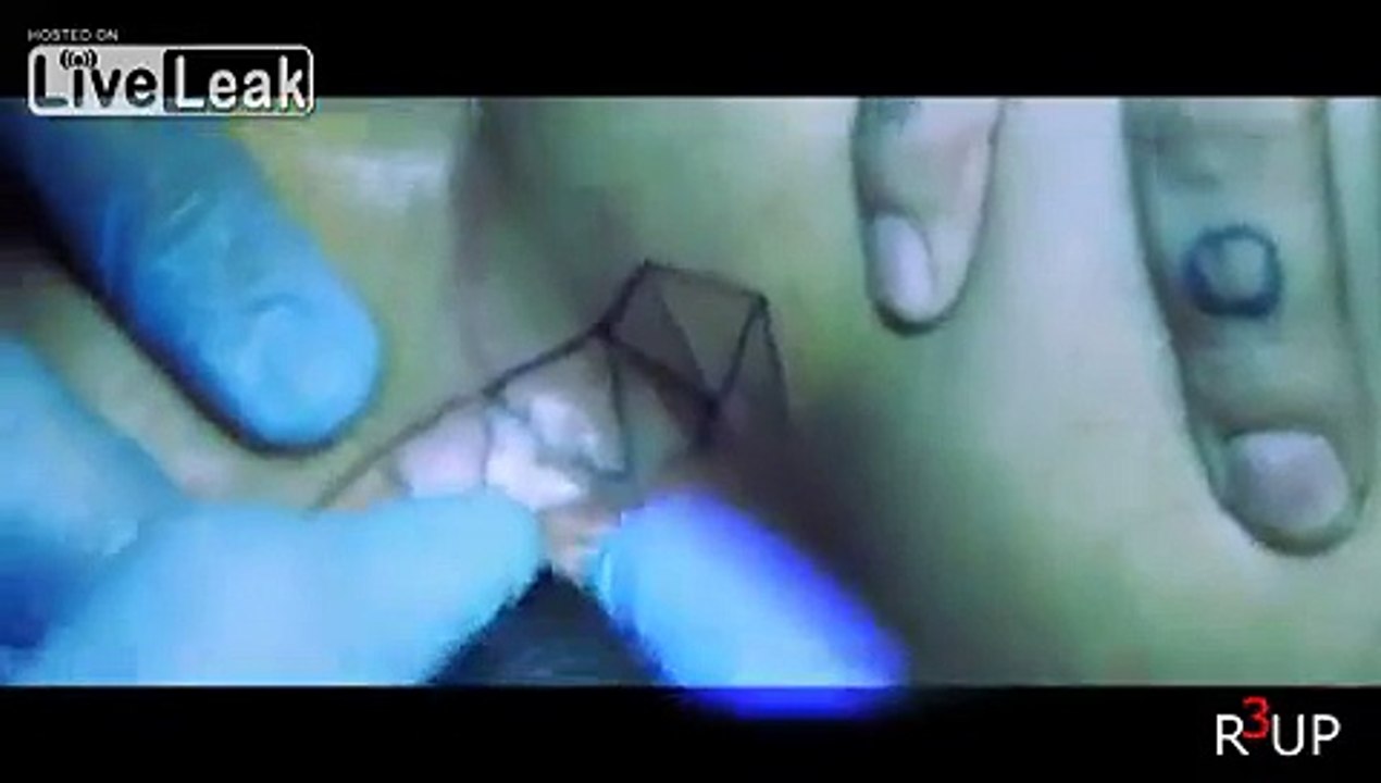 Butt-hole tattoo, who knew!