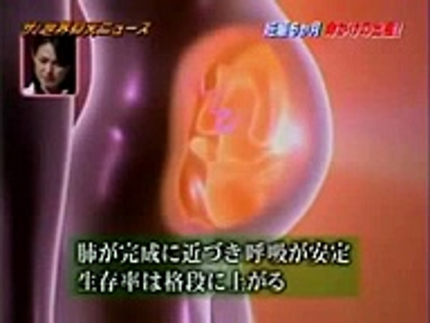 ３９０gの赤ちゃんの奇跡 ザ 世界仰天ニュース Dailymotion Video