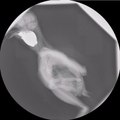 X-ray video: Tawny owl swallowing food