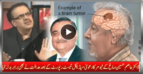 Dr. Asim Hussain Claim Of Brain Tumor And After Medical Test Report Court Takes Equal Revenge