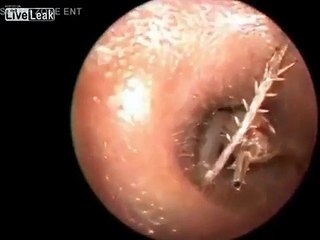 Il lui retire un truc horrible de l'oreille