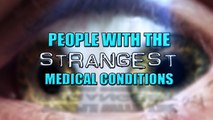 People with the Strangest Medical Conditions.