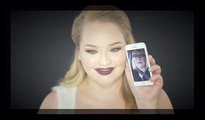 MY LIP INJECTIONS   Q&A!