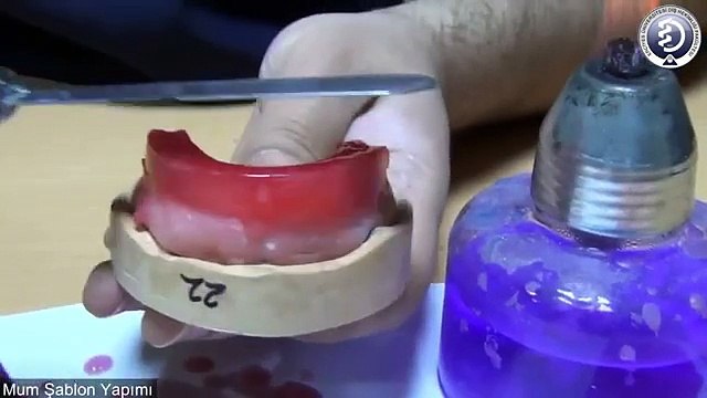 Total Protez Mum Şablon Yapımı