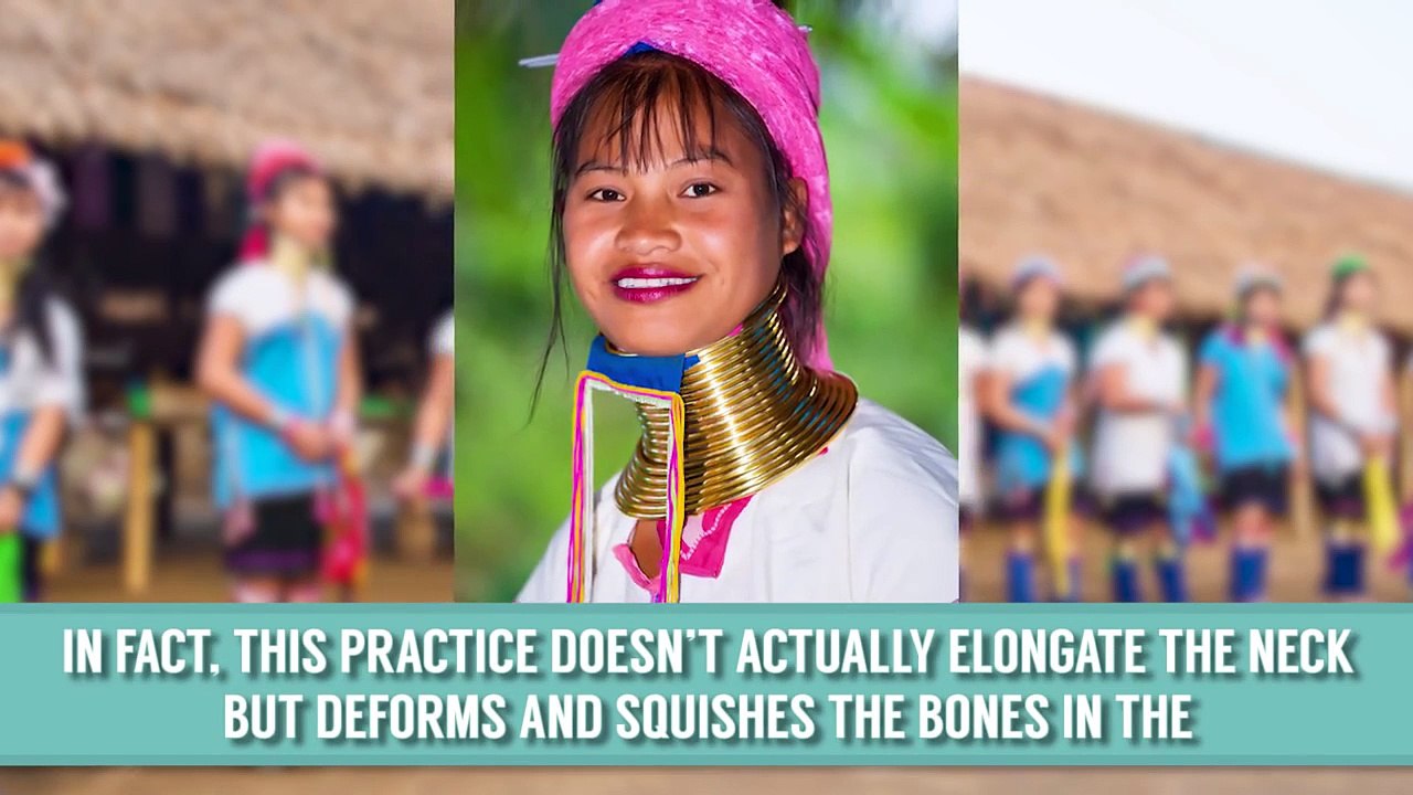 People Who Chose To Deform Their Bodies In Extreme Ways